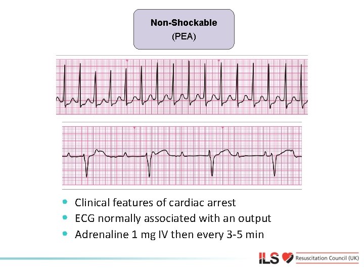 Non-shockable (Asystole) (PEA) Non-Shockable • Clinical features of cardiac arrest • ECG normally associated