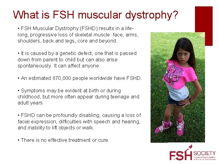 What is FSH muscular dystrophy? • FSH Muscular Dystrophy (FSHD) results in a lifelong,