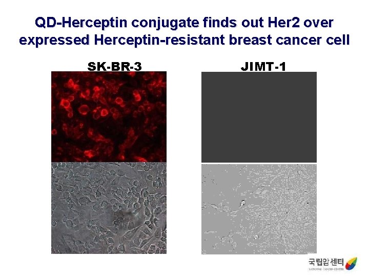 QD-Herceptin conjugate finds out Her 2 over expressed Herceptin-resistant breast cancer cell SK-BR-3 JIMT-1