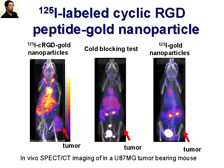 125 I-labeled cyclic RGD peptide-gold nanoparticle 125 I-c. RGD-gold nanoparticles tumor Cold blocking test