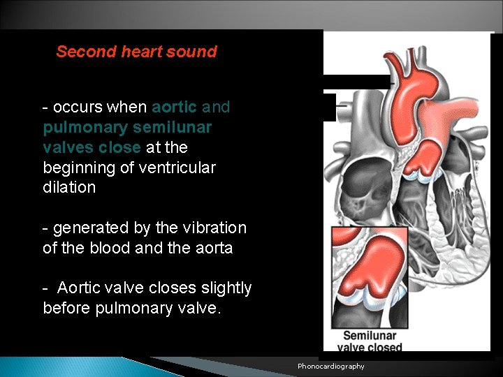 Second heart sound - occurs when aortic and pulmonary semilunar valves close at the