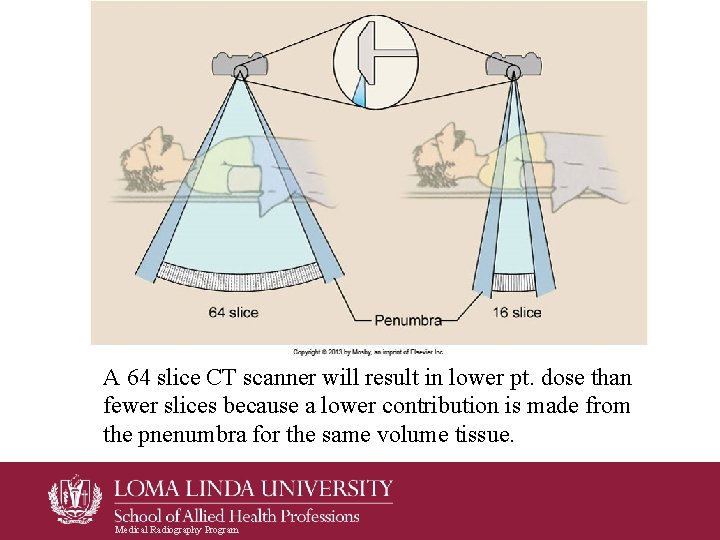 A 64 slice CT scanner will result in lower pt. dose than fewer slices