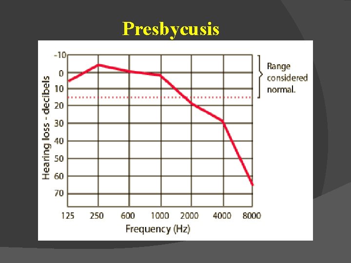 Presbycusis 