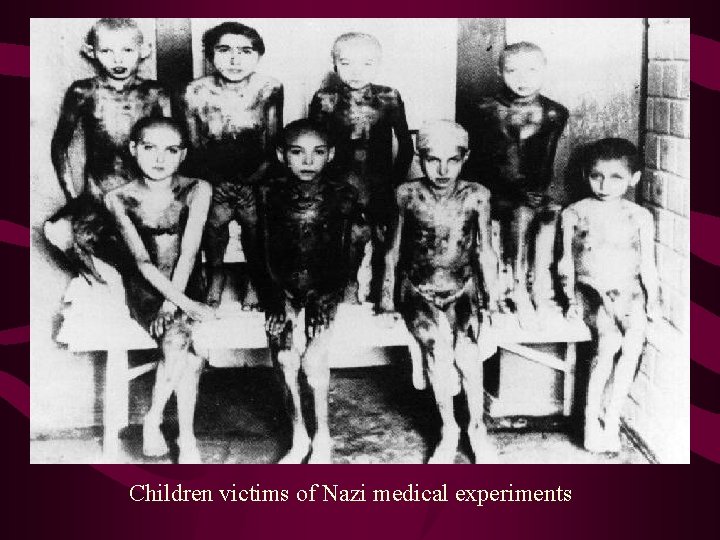 Children victims of Nazi medical experiments 