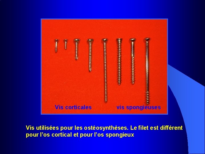 Vis corticales vis spongieuses Vis utilisées pour les ostéosynthèses. Le filet est différent pour