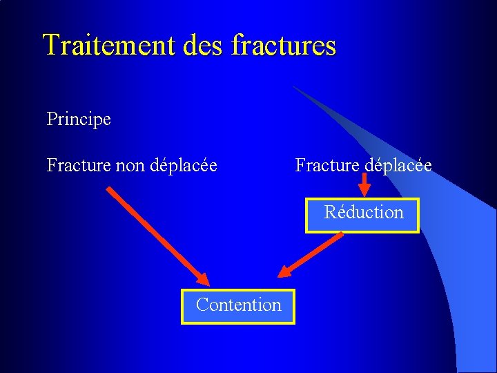 Traitement des fractures Principe Fracture non déplacée Fracture déplacée Réduction Contention 