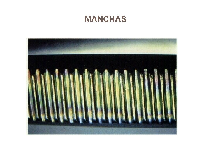 MANCHAS 