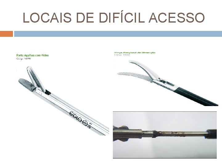 LOCAIS DE DIFÍCIL ACESSO 