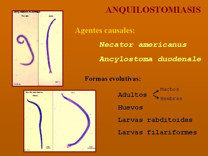 ANQUILOSTOMIASIS Agentes causales: Necator americanus Ancylostoma duodenale Formas evolutivas: Adultos Machos Hembras Huevos Larvas