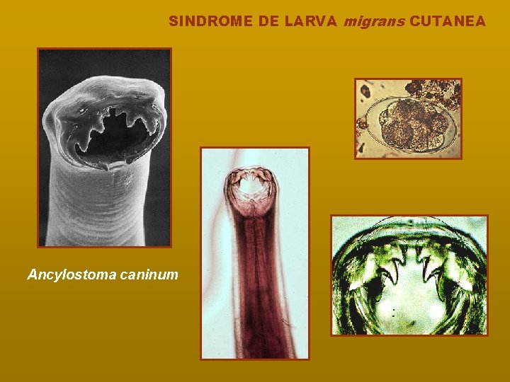SINDROME DE LARVA migrans CUTANEA Ancylostoma caninum 