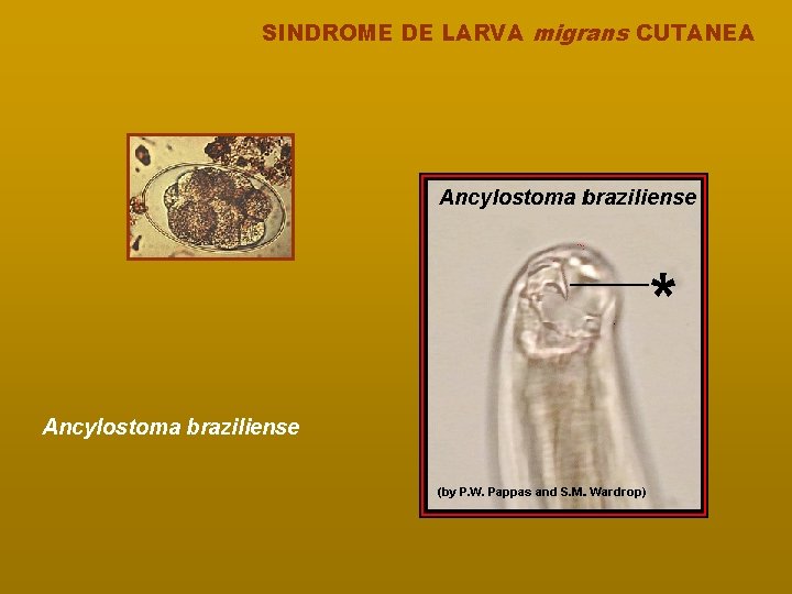 SINDROME DE LARVA migrans CUTANEA Ancylostoma braziliense 