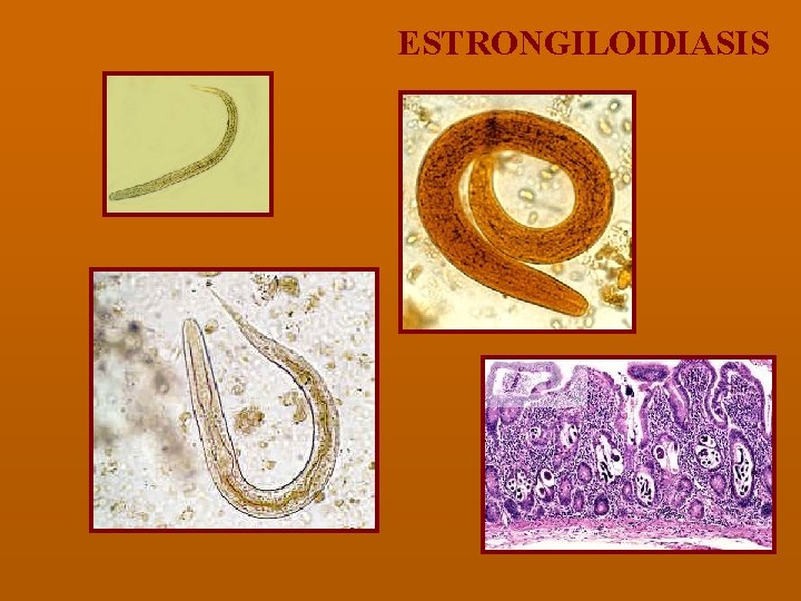 ESTRONGILOIDIASIS 