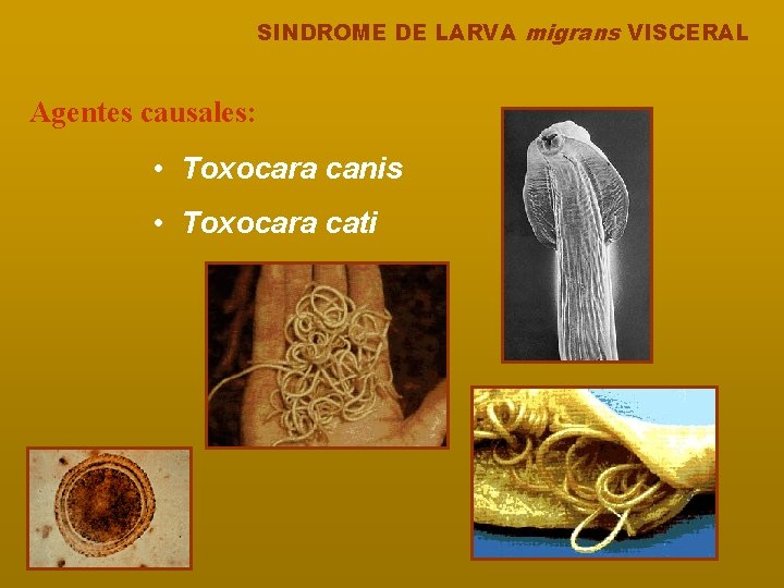 SINDROME DE LARVA migrans VISCERAL Agentes causales: • Toxocara canis • Toxocara cati 