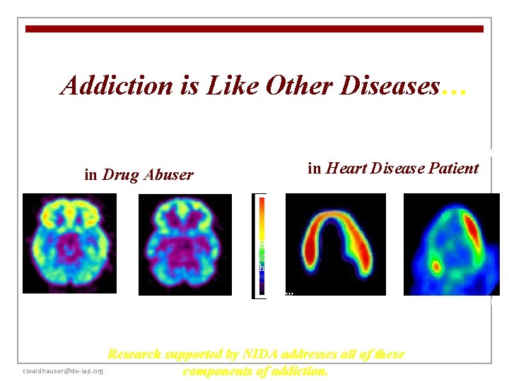 Addiction is Like Other Diseases… Ø It is preventable Ø It is treatable Decreased