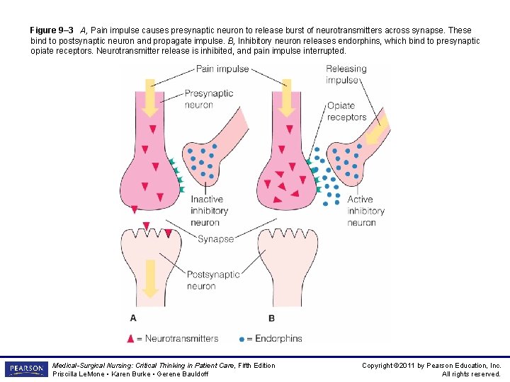 Figure 9– 3 A, Pain impulse causes presynaptic neuron to release burst of neurotransmitters