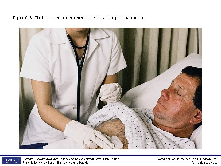 Figure 9– 6 The transdermal patch administers medication in predictable doses. Medical-Surgical Nursing: Critical