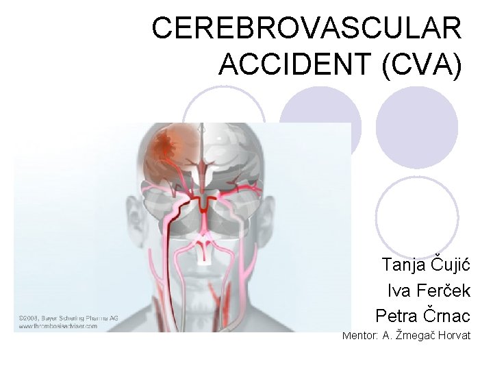 CEREBROVASCULAR ACCIDENT (CVA) Tanja Čujić Iva Ferček Petra Črnac Mentor: A. Žmegač Horvat 