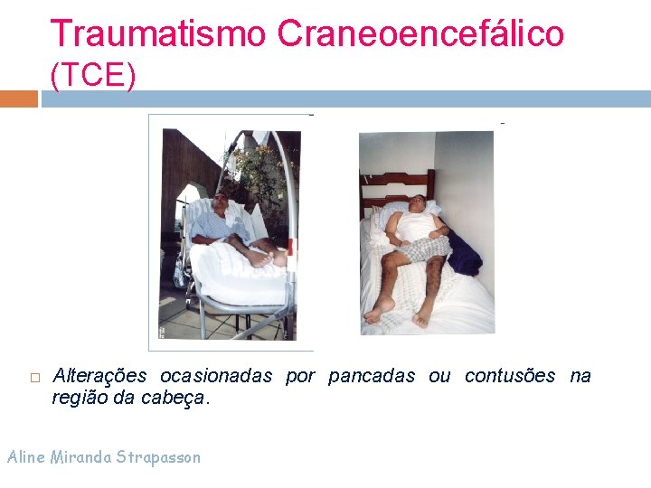 Traumatismo Craneoencefálico (TCE) Alterações ocasionadas por pancadas ou contusões na região da cabeça. Aline