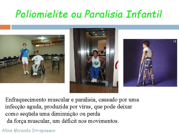 Poliomielite ou Paralisia Infantil Enfraquecimento muscular e paralisia, causado por uma infecção aguda, produzida