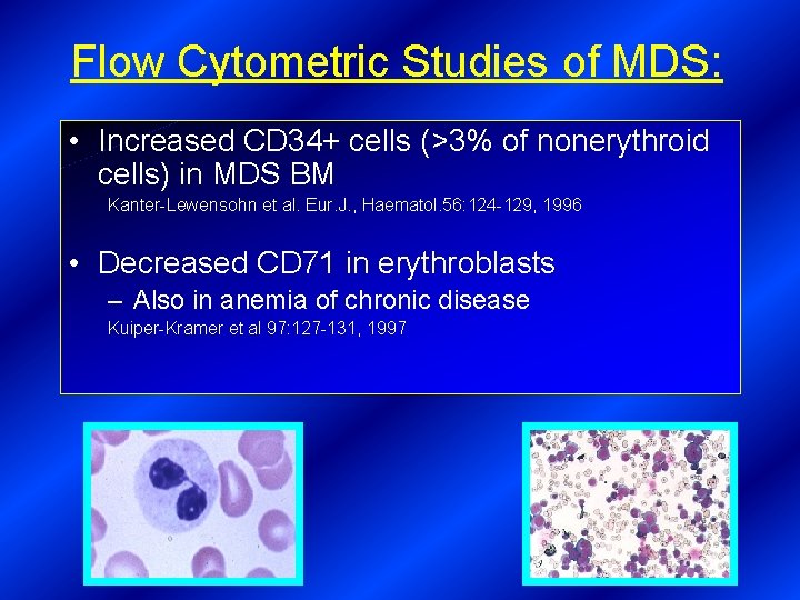 Flow Cytometric Studies of MDS: • Increased CD 34+ cells (>3% of nonerythroid cells)