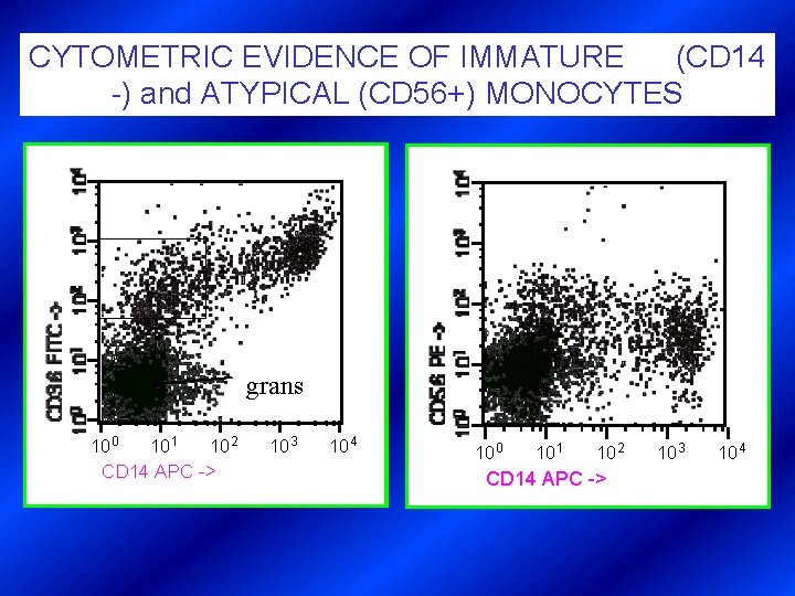CYTOMETRIC EVIDENCE OF IMMATURE (CD 14 -) and ATYPICAL (CD 56+) MONOCYTES grans 10