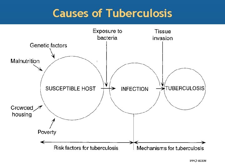 Causes of Tuberculosis 