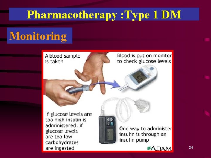 Pharmacotherapy : Type 1 DM Monitoring 84 