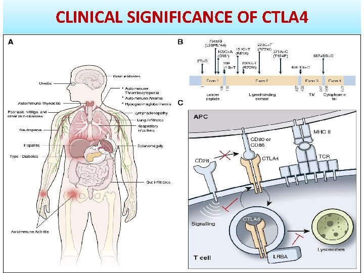 CLINICAL SIGNIFICANCE OF CTLA 4 