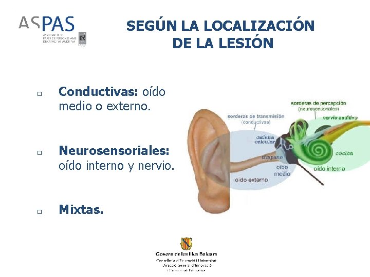 SEGÚN LA LOCALIZACIÓN DE LA LESIÓN □ Conductivas: oído medio o externo. □ Neurosensoriales:
