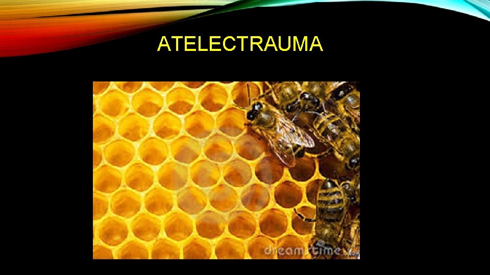 ATELECTRAUMA 