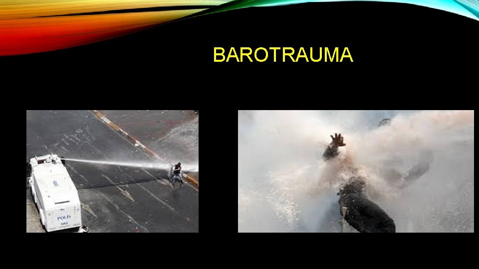 BAROTRAUMA 