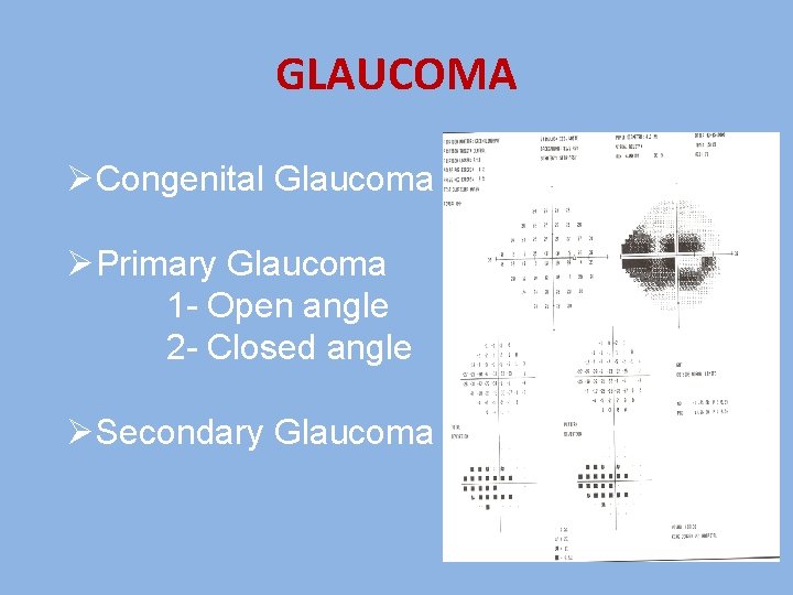 GLAUCOMA ØCongenital Glaucoma ØPrimary Glaucoma 1 - Open angle 2 - Closed angle ØSecondary