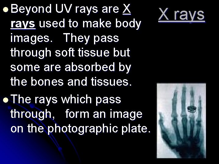 l Beyond UV rays are X rays used to make body images. They pass