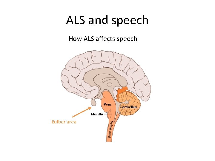 ALS and speech How ALS affects speech Bulbar area 