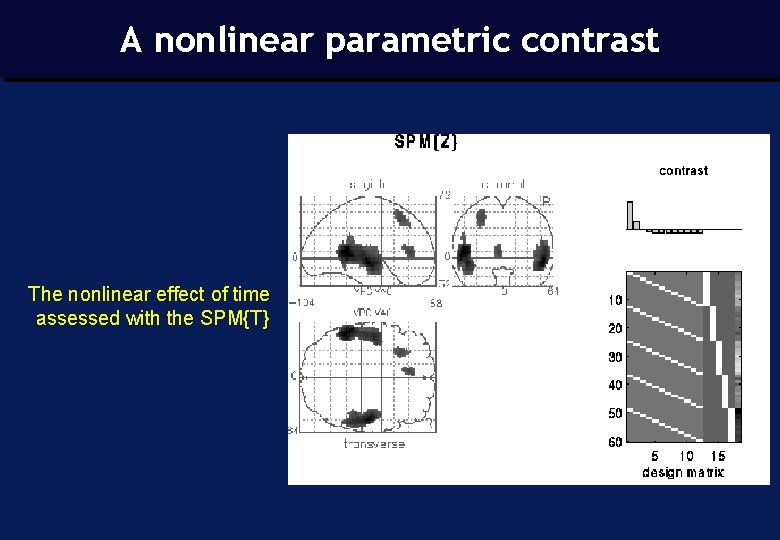 A nonlinear parametric contrast The nonlinear effect of time assessed with the SPM{T} 