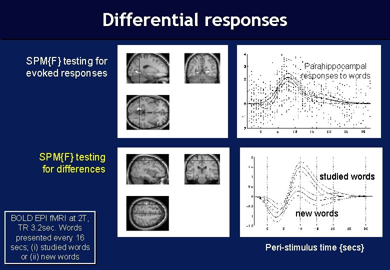 Differential responses Differential event-related f. MRI SPM{F} testing for evoked responses SPM{F} testing for
