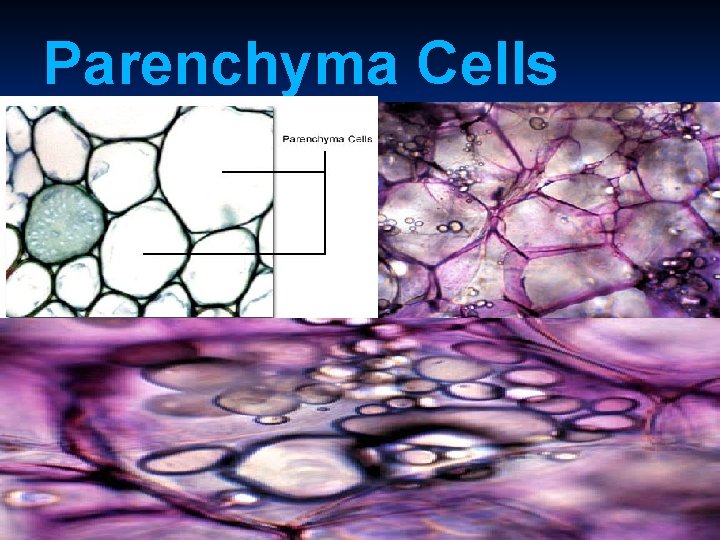 Parenchyma Cells 