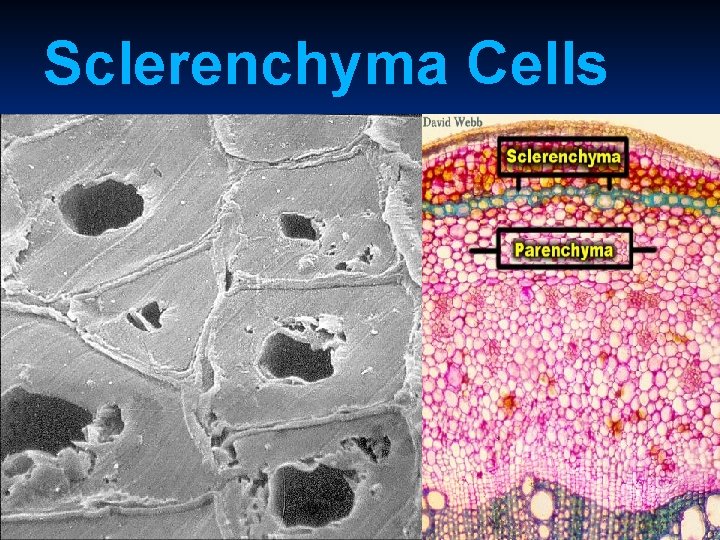 Sclerenchyma Cells 