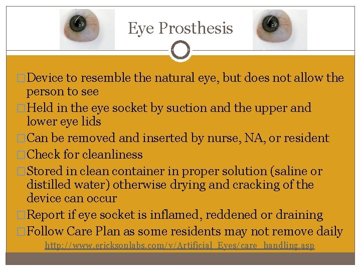 Eye Prosthesis �Device to resemble the natural eye, but does not allow the person