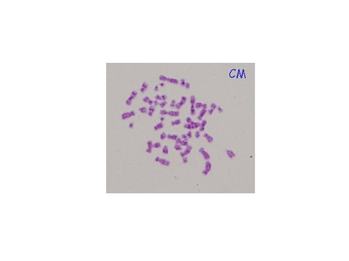 CM 