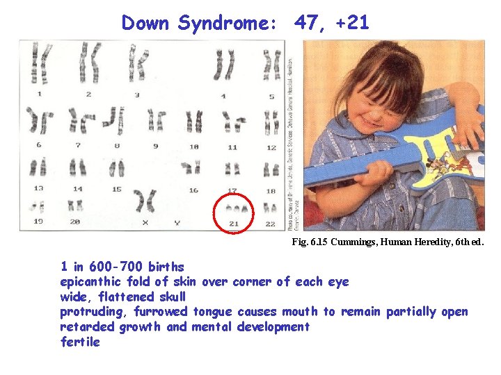 Down Syndrome: 47, +21 Fig. 6. 15 Cummings, Human Heredity, 6 th ed. 1