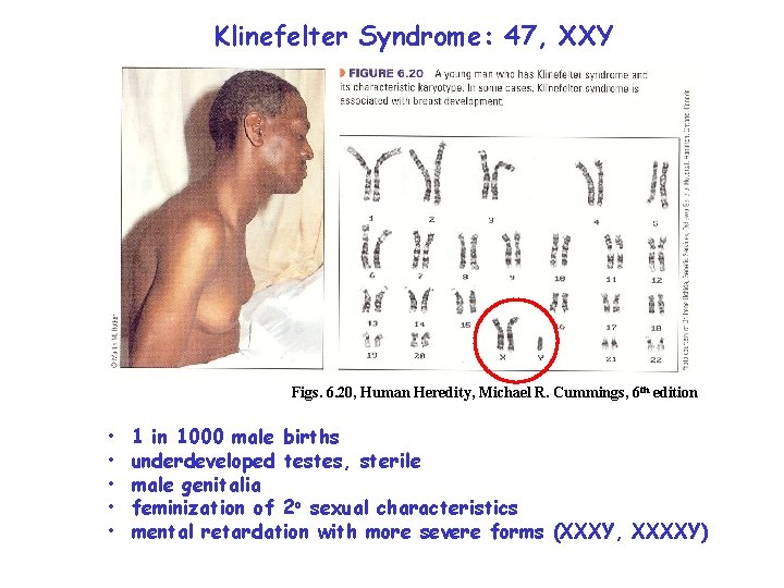 Klinefelter Syndrome: 47, XXY Figs. 6. 20, Human Heredity, Michael R. Cummings, 6 th