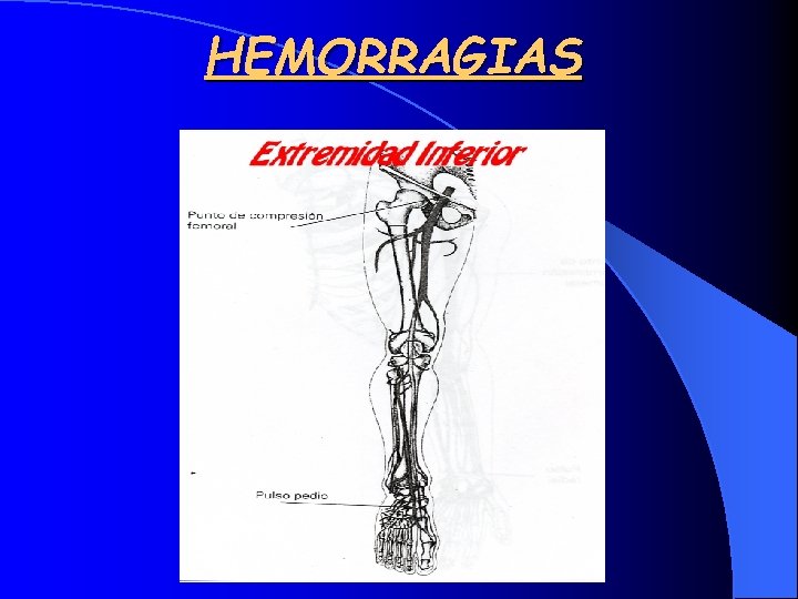 HEMORRAGIAS 