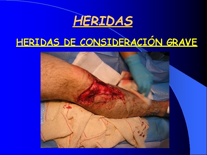HERIDAS DE CONSIDERACIÓN GRAVE 