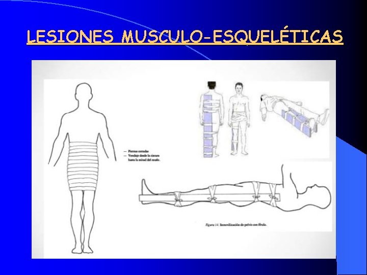 LESIONES MUSCULO-ESQUELÉTICAS 