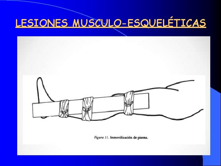 LESIONES MUSCULO-ESQUELÉTICAS 