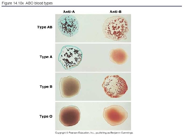 Figure 14. 10 x ABO blood types 