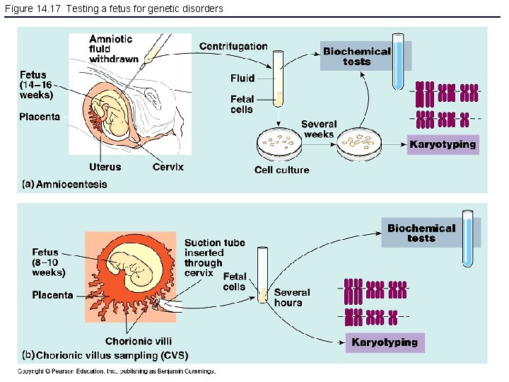 Figure 14. 17 Testing a fetus for genetic disorders 