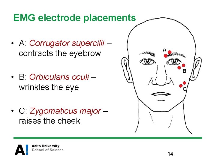 EMG electrode placements • A: Corrugator supercilii – contracts the eyebrow A B •