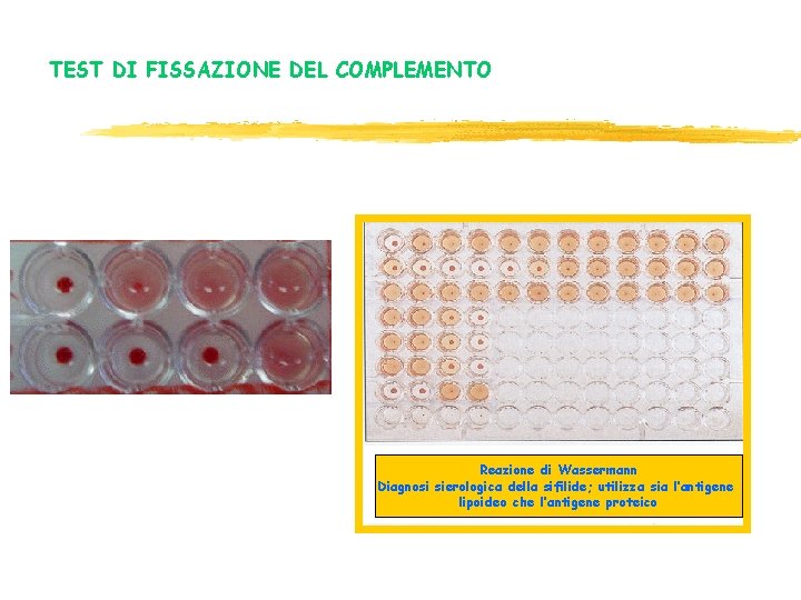 TEST DI FISSAZIONE DEL COMPLEMENTO +/+ Reazione di Wassermann Diagnosi sierologica della sifilide; utilizza TEST DI FISSAZIONE DEL COMPLEMENTO +/+ Reazione di Wassermann Diagnosi sierologica della sifilide; utilizza